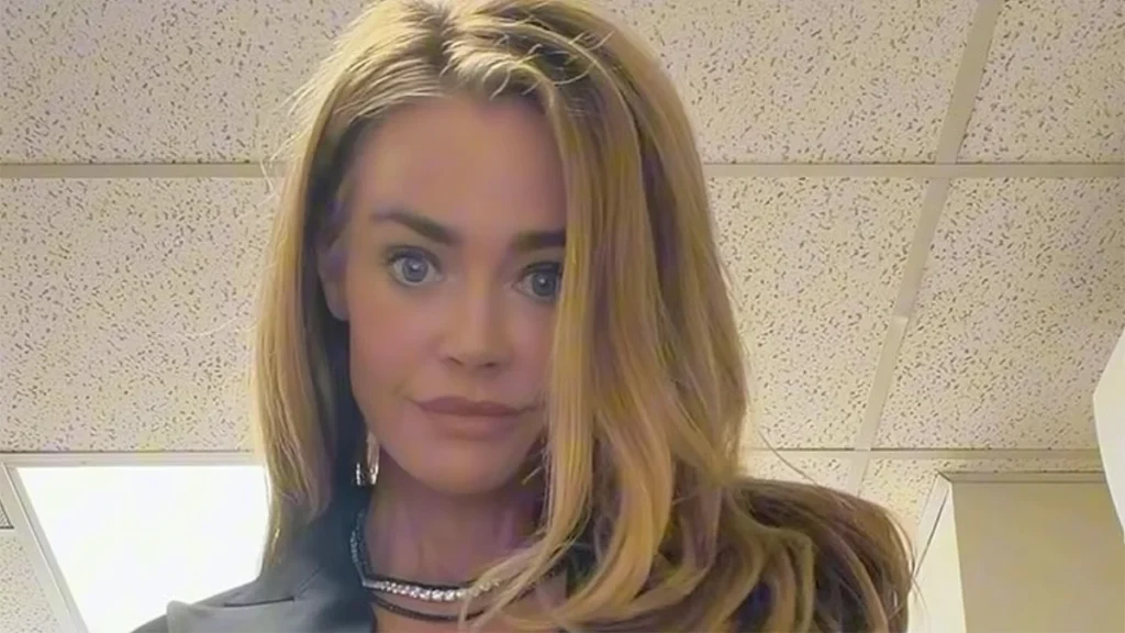 Denise Richards habla de su lifting facial, de sus efectos y de cómo lo vivió.